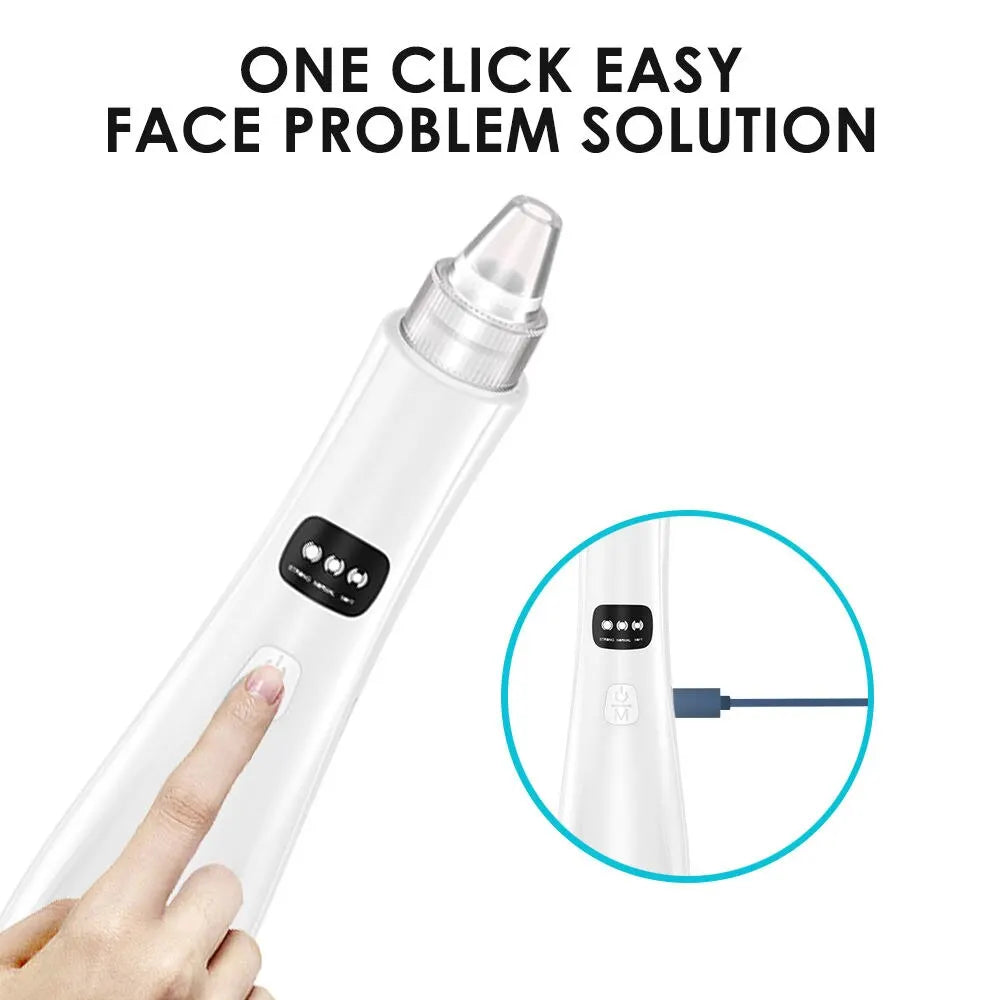 Blackhead Remover Vacuum