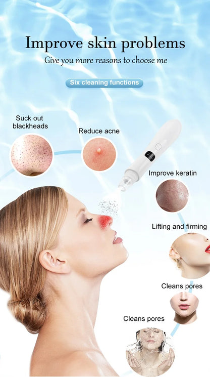 Blackhead Remover Vacuum