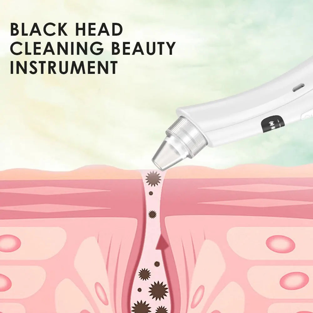 Blackhead Remover Vacuum