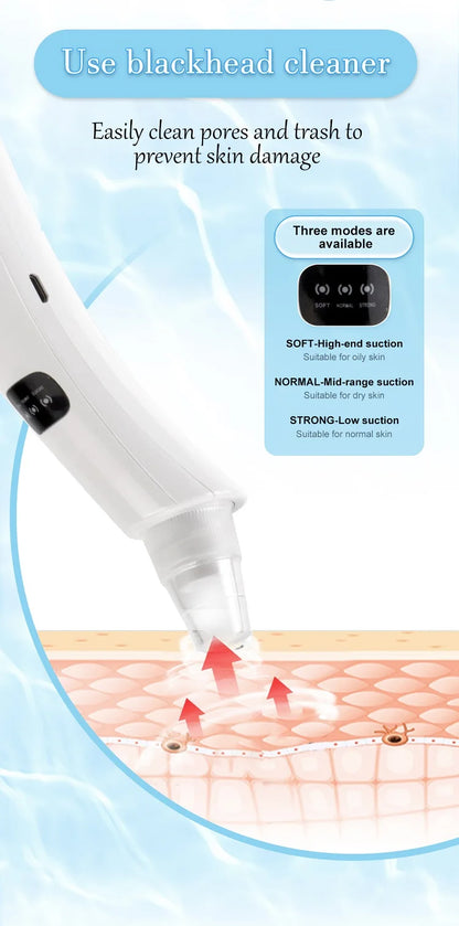 Blackhead Remover Vacuum